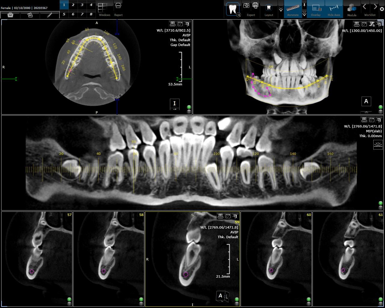 CBCT Dental System-3Dnet