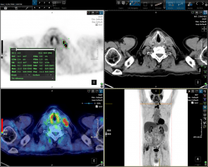 PET/CT